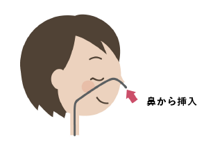 経鼻（鼻から挿入）、経口（口から挿入）を選択できます。